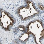 PSMA Antibody in Immunohistochemistry (Paraffin) (IHC (P))