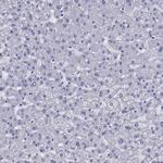 CD1a Antibody in Immunohistochemistry (Paraffin) (IHC (P))