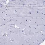 CD1a Antibody in Immunohistochemistry (Paraffin) (IHC (P))