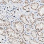 GALNT2 Antibody in Immunohistochemistry (Paraffin) (IHC (P))