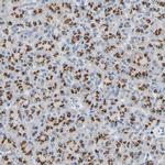 GALNT2 Antibody in Immunohistochemistry (Paraffin) (IHC (P))