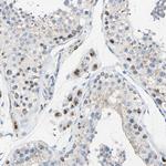 GALNT2 Antibody in Immunohistochemistry (Paraffin) (IHC (P))