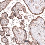 ACSL3 Antibody in Immunohistochemistry (Paraffin) (IHC (P))