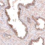 ACSL3 Antibody in Immunohistochemistry (Paraffin) (IHC (P))