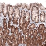 ACSL3 Antibody in Immunohistochemistry (Paraffin) (IHC (P))