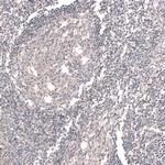 ACSL3 Antibody in Immunohistochemistry (Paraffin) (IHC (P))