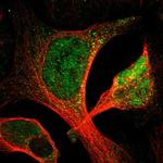 ACSL1 Antibody in Immunocytochemistry (ICC/IF)