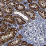 ACSL1 Antibody in Immunohistochemistry (Paraffin) (IHC (P))