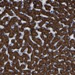 ACSL1 Antibody in Immunohistochemistry (Paraffin) (IHC (P))