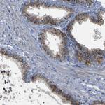 ACSL1 Antibody in Immunohistochemistry (Paraffin) (IHC (P))