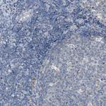 ACSL1 Antibody in Immunohistochemistry (Paraffin) (IHC (P))