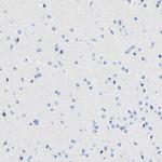 Desmocollin 2 Antibody in Immunohistochemistry (Paraffin) (IHC (P))