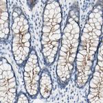 Desmocollin 2 Antibody in Immunohistochemistry (Paraffin) (IHC (P))