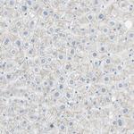 Desmocollin 2 Antibody in Immunohistochemistry (Paraffin) (IHC (P))