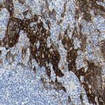 Desmocollin 2 Antibody in Immunohistochemistry (Paraffin) (IHC (P))