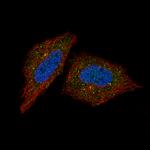 Synaptojanin 1 Antibody in Immunocytochemistry (ICC/IF)