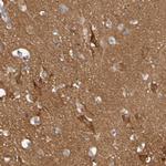 Synaptojanin 1 Antibody in Immunohistochemistry (Paraffin) (IHC (P))