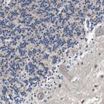 LRP4 Antibody in Immunohistochemistry (Paraffin) (IHC (P))