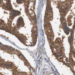 LRP4 Antibody in Immunohistochemistry (Paraffin) (IHC (P))