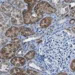 ACSL1 Antibody in Immunohistochemistry (Paraffin) (IHC (P))