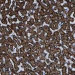 ACSL1 Antibody in Immunohistochemistry (Paraffin) (IHC (P))