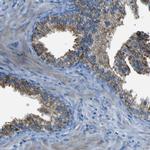 ACSL1 Antibody in Immunohistochemistry (Paraffin) (IHC (P))