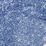 ACSL1 Antibody in Immunohistochemistry (Paraffin) (IHC (P))