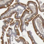 GCS1 Antibody in Immunohistochemistry (Paraffin) (IHC (P))