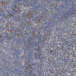 GCS1 Antibody in Immunohistochemistry (Paraffin) (IHC (P))