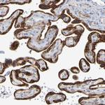 GCS1 Antibody in Immunohistochemistry (Paraffin) (IHC (P))