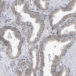 GCS1 Antibody in Immunohistochemistry (Paraffin) (IHC (P))