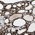 ACADL Antibody in Immunohistochemistry (Paraffin) (IHC (P))