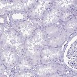 Cytokeratin 10 Antibody in Immunohistochemistry (Paraffin) (IHC (P))