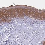 Cytokeratin 10 Antibody in Immunohistochemistry (Paraffin) (IHC (P))