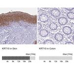 Cytokeratin 10 Antibody