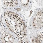 ErbB4 Antibody in Immunohistochemistry (Paraffin) (IHC (P))