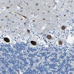 STIM1 Antibody in Immunohistochemistry (Paraffin) (IHC (P))