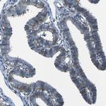 STIM1 Antibody in Immunohistochemistry (Paraffin) (IHC (P))