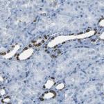 STIM1 Antibody in Immunohistochemistry (Paraffin) (IHC (P))