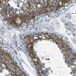 STIM1 Antibody in Immunohistochemistry (Paraffin) (IHC (P))