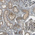 LPCAT1 Antibody in Immunohistochemistry (Paraffin) (IHC (P))