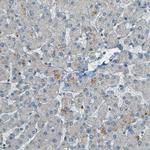 LPCAT1 Antibody in Immunohistochemistry (Paraffin) (IHC (P))