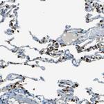 LPCAT1 Antibody in Immunohistochemistry (Paraffin) (IHC (P))