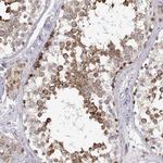 ENDOGL1 Antibody in Immunohistochemistry (Paraffin) (IHC (P))