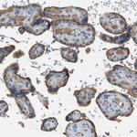 CD155 Antibody in Immunohistochemistry (Paraffin) (IHC (P))