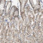 CD155 Antibody in Immunohistochemistry (Paraffin) (IHC (P))