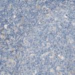 CD155 Antibody in Immunohistochemistry (Paraffin) (IHC (P))