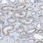 CD49f Antibody in Immunohistochemistry (Paraffin) (IHC (P))