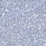 CD49f Antibody in Immunohistochemistry (Paraffin) (IHC (P))