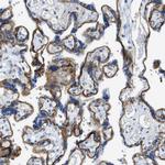 CD49f Antibody in Immunohistochemistry (Paraffin) (IHC (P))